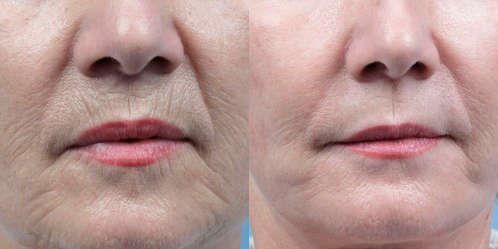 8e5fc245fc0633b061feebd66ee85626-1